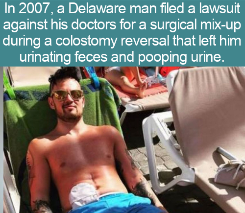 colostomy bag men - In 2007, a Delaware man filed a lawsuit against his doctors for a surgical mixup during a colostomy reversal that left him urinating feces and pooping urine.