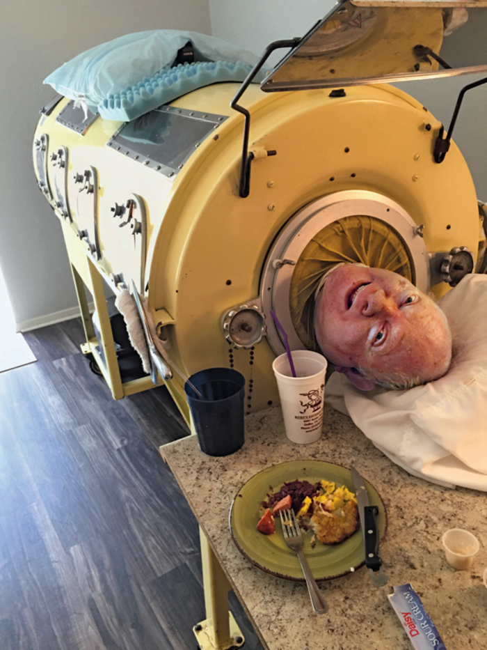 There is still someone in the US living in an iron lung.