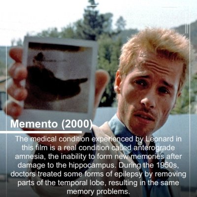 guy pearce memento - Memento 2000 The medical condition experienced by Leonard in this film is a real condition called anterograde amnesia, the inability to form new memories after damage to the hippocampus. During the 1950s, doctors treated some forms of