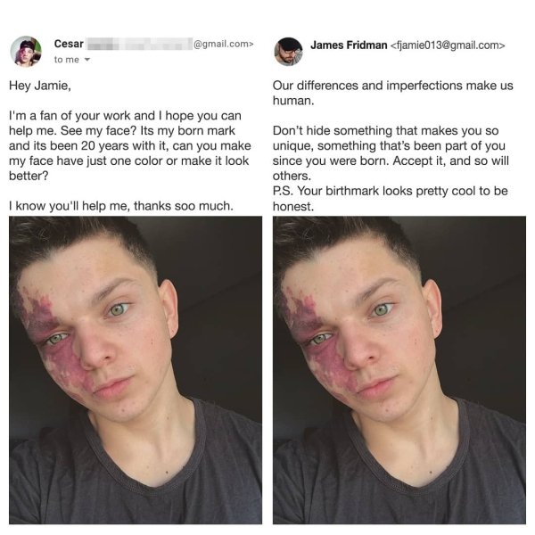 james fridman - James Fridman  Our differences and imperfections make us human. Cesar .com> to me Hey Jamie, I'm a fan of your work and I hope you can help me. See my face? Its my born mark and its been 20 years with it, can you make my face have just one