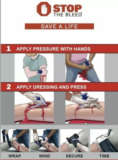 tips medical - Ostop The Bleed Save A Life 1 Apply Pressure With Hands 2 Apply Dressing And Press Wrap Wind Secure Time