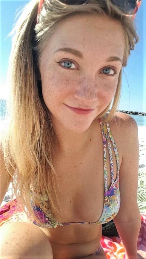 33 Girls With Freckles