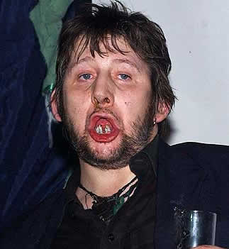 Shane MacGowan lead singer of The Pogues