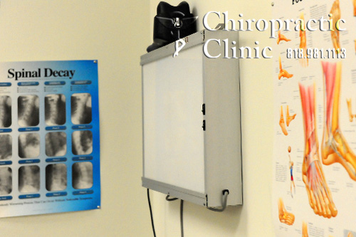chiropractic X-ray View Box