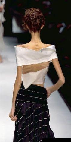 skinny anorexic model