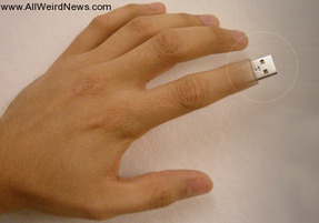 lost finger replaced with usb, actual photo