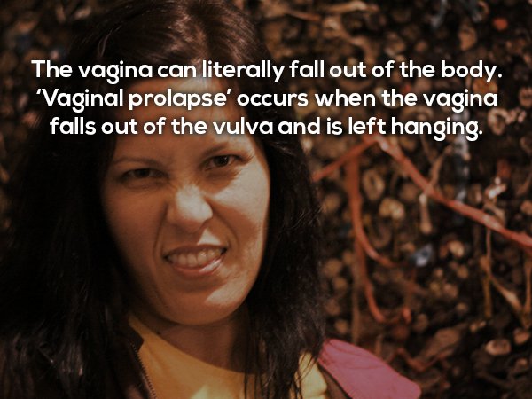 Gross medical condition in which the vagina falls out of the body.