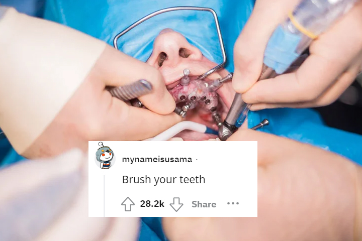 what would you tell your 13 year old self - major oral surgery - mynameisusama Brush your teeth