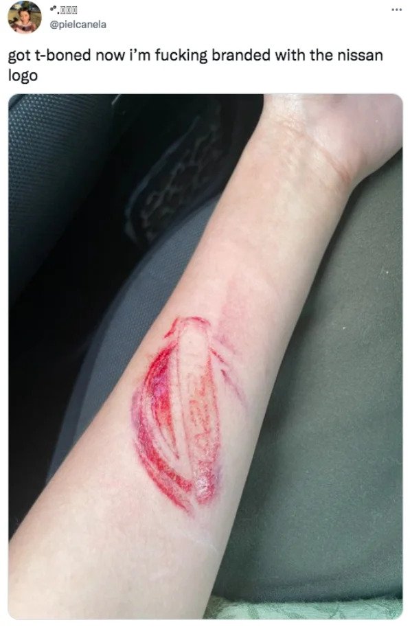 funny tweets - arm - got tboned now i'm fucking branded with the nissan logo 3