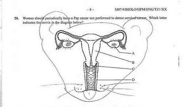 funny test answers uterus - MBiolohpmEngT21Xx 20. Women should periodically have a Pap smear test performed to detect cervical cancer. Which letter indicates the cervix in the diagram below2