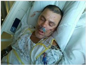 http://www2.wkrg.com/news/2012/apr/23/man-beaten-mob-critical-condition-ar-3659891/