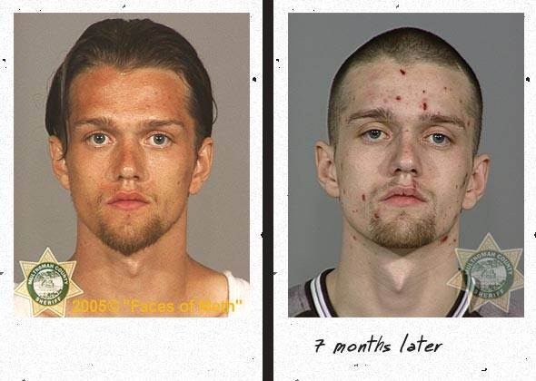 faces of meth - 005 Eaces oth 7 months later