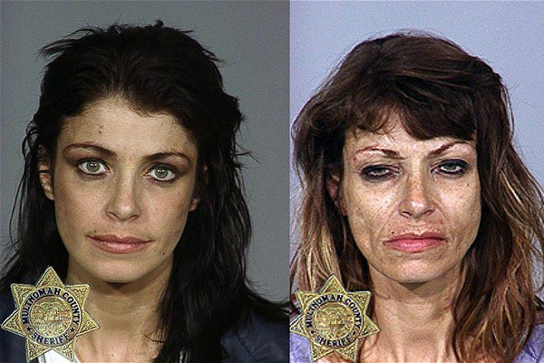 before and after drugs