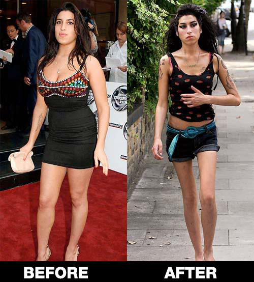 amy winehouse before and after - Before After