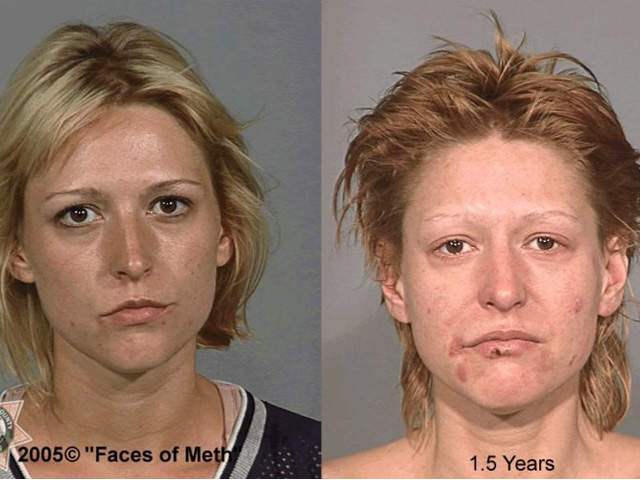 faces of meth - 2005 "Faces of Meth 1.5 Years