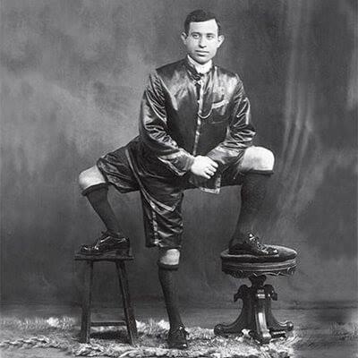 Frank Lentini, born with a parasitic twin had 3 legs, 4 feet, 16 toes and 2 functioning sets of genitals