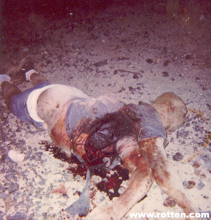 some really grose pics of dead people 3