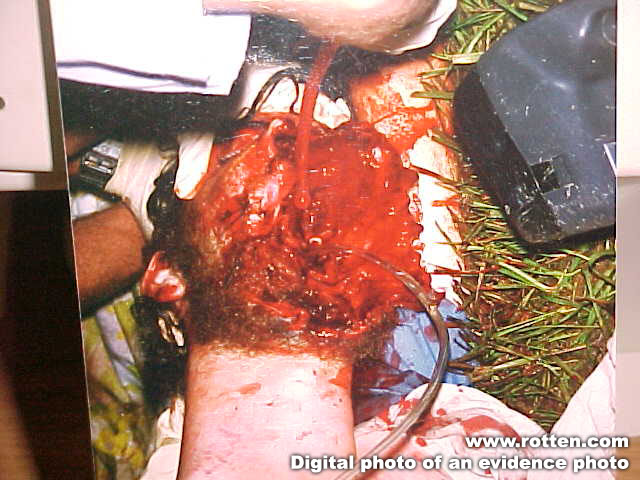 some really grose pics of dead people 3