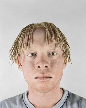 Svart Albino