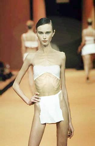 Anorexic Gallery
