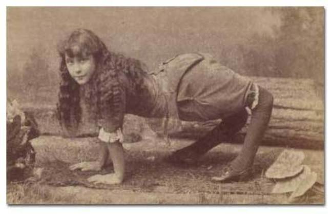 Ella Harper, who suffered from a disorder that weakens the ligaments in the knees, was known as Camel Girl.