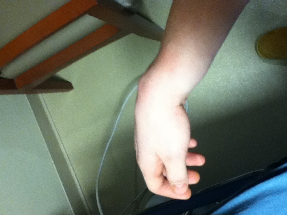 I broke my wrist!