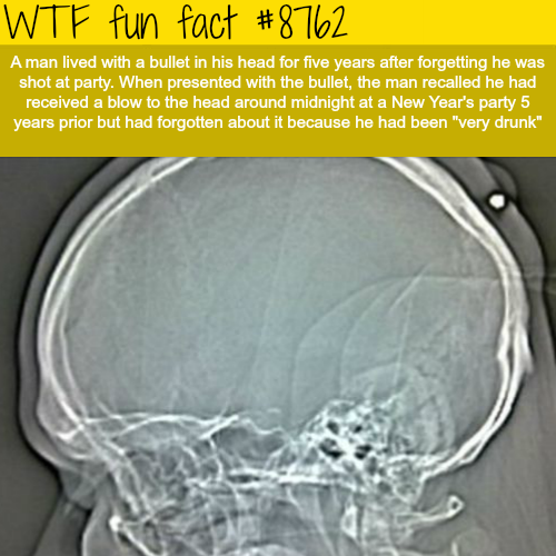25 Weird Facts to Make You Feel Smarter