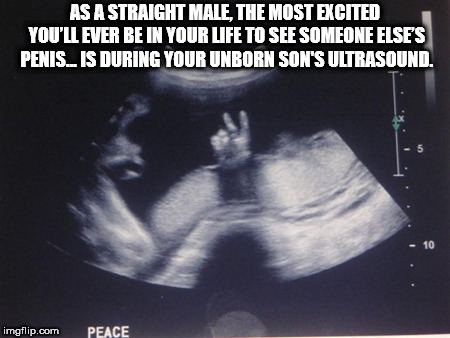 prank sonogram - As A Straight Male, The Most Excited You'Ll Ever Be In Your Life To See Someone Else'S Penis.Is During Your Unborn Son'S Ultrasound. imgflip.com Peace