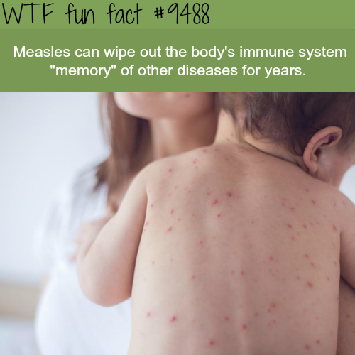 chicken pox in vaccinated child - Wtf fun fact Measles can wipe out the body's immune system "memory" of other diseases for years.