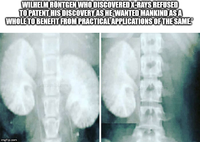 radiology - Wilhelm Rntgen Who Discovered XRays Refused To Patent His Discovery As He Wanted Mankind As A Whole To Benefit From Practical Applications Of The Same' imgflip.com