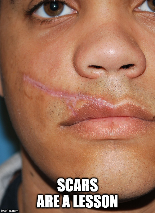 lip - Scars Are A Lesson imgflip.com