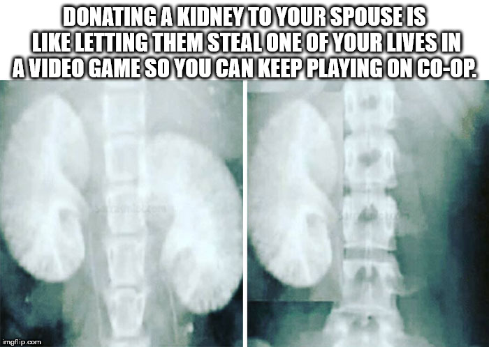 shower thought before and after buying iphone x meme - Donating A Kidney To Your Spouse Is Letting Them Steal One Of Your Lives In A Video Game So You Can Keep Playing On CoOp. imgflip.com