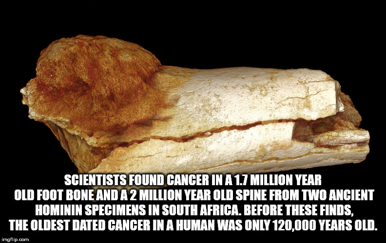 40 Facts That'll Swell Your Brain in Your Skull