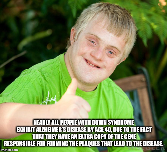 down syndrome kid thumbs up - Nearly All People With Down Syndrome Exhibit Alzheimer'S Disease By Age 40, Due To The Fact That They Have An Extra Copy Of The Gene Responsible For Forming The Plaques That Lead To The Disease. imgflip.com