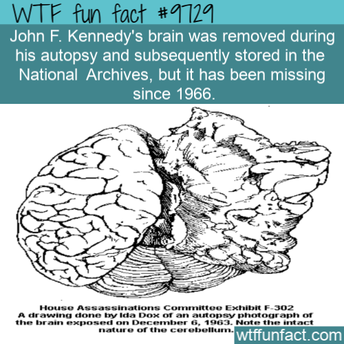 kennedy's brain - Wtf fun fact John F. Kennedy's brain was removed during his autopsy and subsequently stored in the National Archives, but it has been missing since 1966. House Assassinations Committee Exhibit F302 A drawing done by Ida Dox of an autopsy
