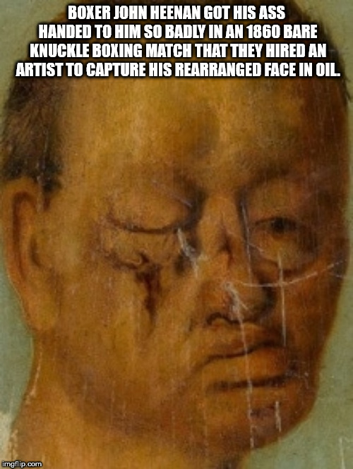 human - Boxer John Heenan Got His Ass Handed To Him So Badly In An 1860 Bare Knuckle Boxing Match That They Hired An Artist To Capture His Rearranged Face In Oil imgflip.com