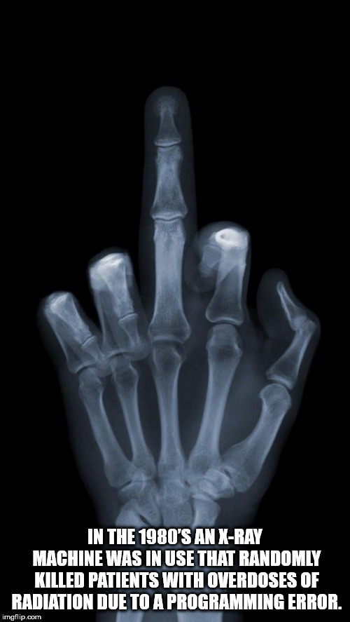 middle finger - In The 1980'S An XRay Machine Was In Use That Randomly Killed Patients With Overdoses Of Radiation Due To A Programming Error. imgflip.com