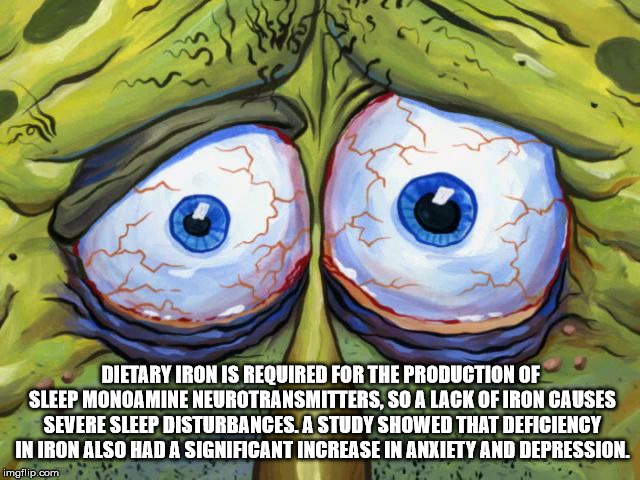 spongebob insomniac face - Dietary Iron Is Required For The Production Of Sleep Monoamine Neurotransmitters, So A Lack Of Iron Causes Severe Sleep Disturbances. A Study Showed That Deficiency In Iron Also Had A Significant Increase In Anxiety And Depressi