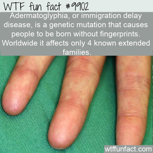 weird facts - Wtf fun fact Adermatoglyphia, or immigration delay disease, is a genetic mutation that causes people to be born without fingerprints. Worldwide it affects only 4 known extended families. wtffunfact.com