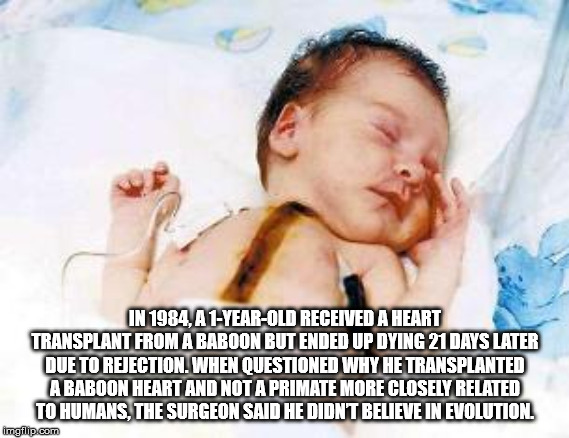 baby fae - In 1984. A 1YearOld Received A Heart Transplant From A Baboon But Ended Up Dying 21 Days Later Due To Rejection. When Questioned Why He Transplanted A Baboon Heart And Not A Primate More Closely Related To Humans, The Surgeon Said He Didnt Beli