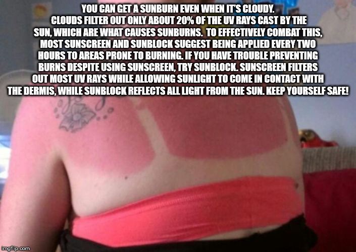 abdomen - You Can Get A Sunburn Even When It'S Cloudy. Clouds Filter Out Only About 20% Of The Uv Rays Cast By The Sun. Which Are What Causes Sunburns. To Effectively Combat This. Most Sunscreen And Sunblock Suggest Being Applied Every Two Hours To Areas 