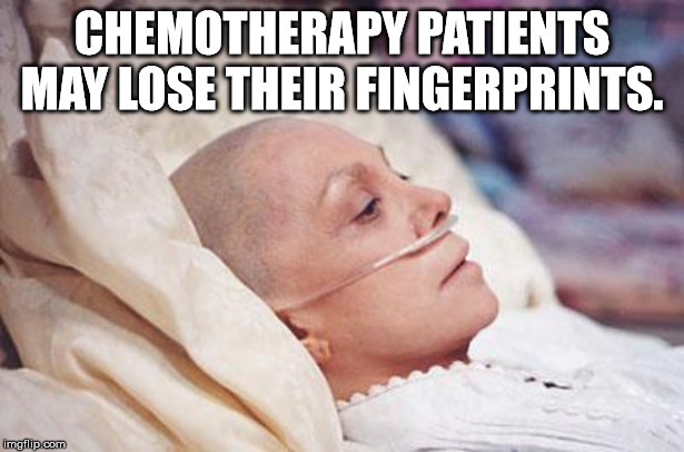 ireland - Chemotherapy Patients May Lose Their Fingerprints. imgflip.com