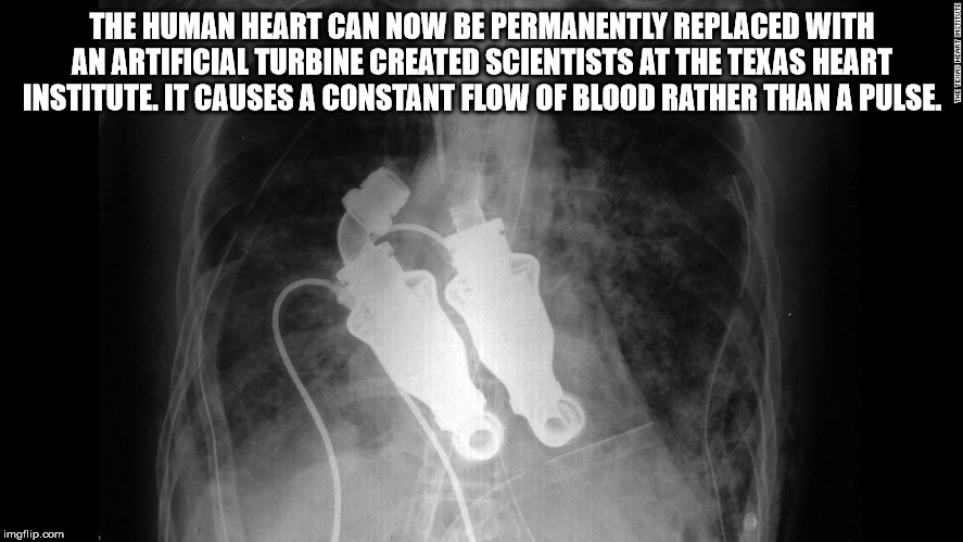 medical radiography - The Human Heart Can Now Be Permanently Replaced With An Artificial Turbine Created Scientists At The Texas Heart Institute. It Causes A Constant Flow Of Blood Rather Than A Pulse. The Terasemat Petitute imgflip.com