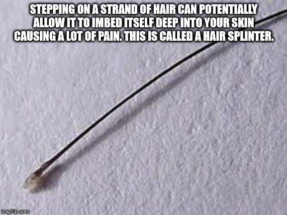 material - Stepping On A Strand Of Hair Can Potentially Allow It To Imbed Itself Deep Into Your Skin Causing A Lot Of Pain. This Is Called A Hair Splinter. imgflip.com