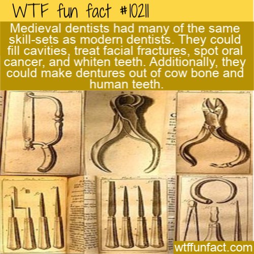 brass - Wtf fun fact #|02|| Medieval dentists had many of the same skillsets as modern dentists. They could fill cavities, treat facial fractures, spot oral cancer, and whiten teeth. Additionally, they could make dentures out of cow bone and human teeth.…