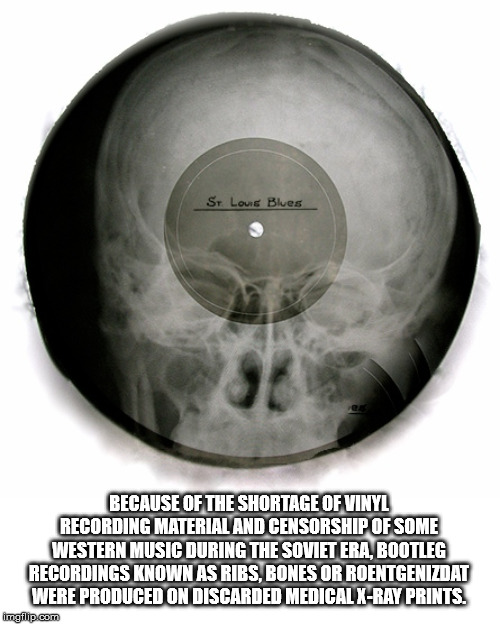 St. Louis Blues Because Of The Shortage Of Vinyl Recording Material And Censorship Of Some Western Music During The Soviet Era, Bootleg Recordings Known As Ribs, Bones Or Roentgenizdat Were Produced On Discarded Medical XRay Prints. imalip.com