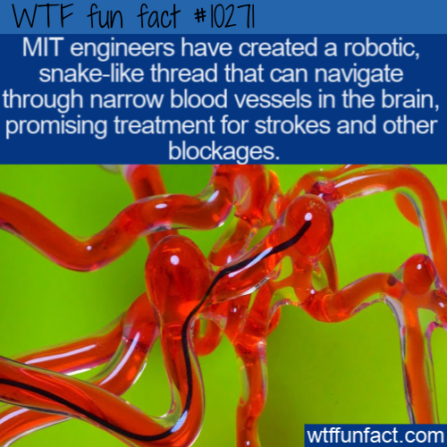 organ - Wtf fun fact Mit engineers have created a robotic, snake thread that can navigate through narrow blood vessels in the brain, promising treatment for strokes and other blockages. wtffunfact.com