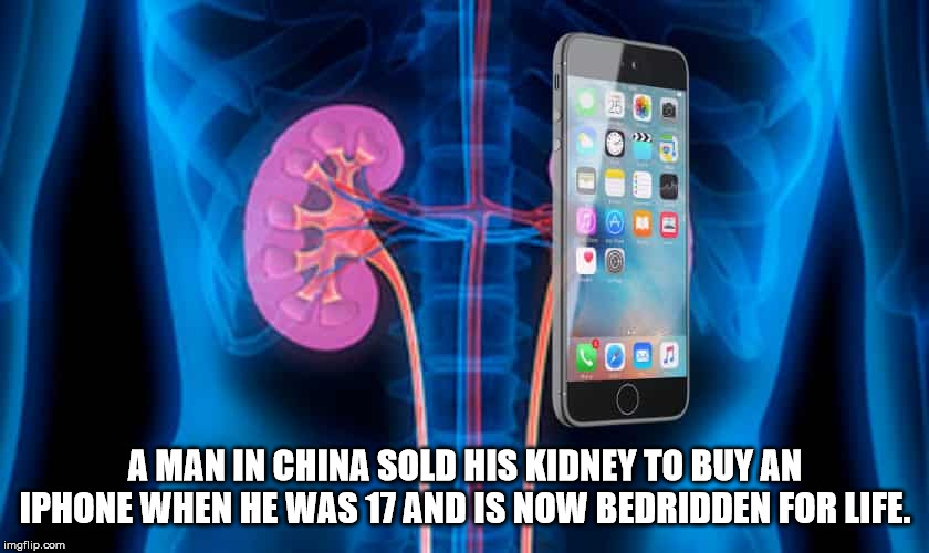 electronics - A Man In China Sold His Kidney To Buy An Iphone When He Was 17 And Is Now Bedridden For Life. imgflip.com