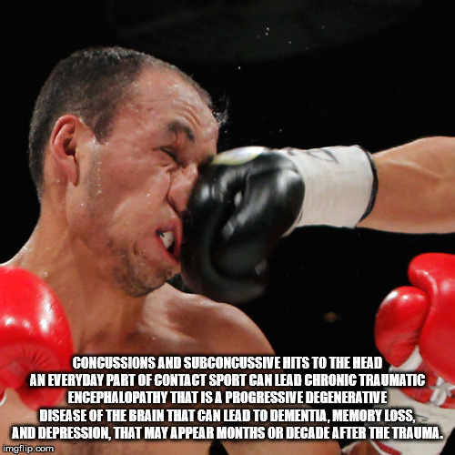 funny boxing knockouts - Concussions And Subconcussive Hits To The Head An Everyday Part Of Contact Sport Can Lead Chronic Traumatic Encephalopathy That Is A Progressive Degenerative Disease Of The Brain That Can Lead To Dementia, Memory Loss, And Depress