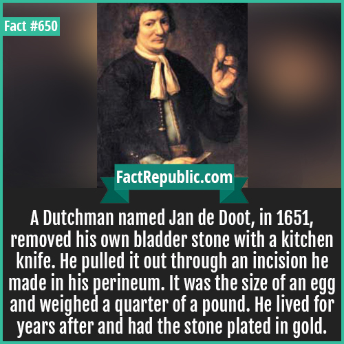 alkohol ab 18 - Fact FactRepublic.com A Dutchman named Jan de Doot, in 1651, removed his own bladder stone with a kitchen knife. He pulled it out through an incision he made in his perineum. It was the size of an egg and weighed a quarter of a pound. He l